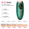 Portable IPL Hair Removal Epilator